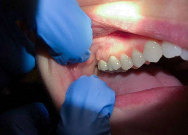 Best Weekend Emergency Dentist in Sunnyslope, WA